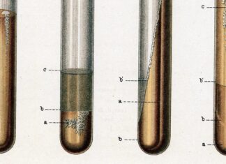 Tuberkulose nimmt in den USA wieder zu: Eine stille Epidemie